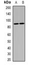 Gamma-interferon-inducible protein 16 antibody, orb378116, Biorbyt, Western Blot image 