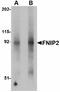 Folliculin-interacting protein 2 antibody, LS-B4600, Lifespan Biosciences, Western Blot image 