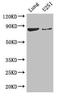YTH Domain Containing 1 antibody, orb46503, Biorbyt, Western Blot image 