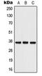 Podoplanin antibody, LS-C353292, Lifespan Biosciences, Western Blot image 