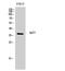 Immunoglobulin Heavy Constant Gamma 1 (G1m Marker) antibody, A04575-1, Boster Biological Technology, Western Blot image 