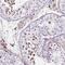 Kinetochore protein Spc24 antibody, NBP2-47264, Novus Biologicals, Immunohistochemistry paraffin image 