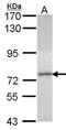 DEAD-Box Helicase 1 antibody, GTX107931, GeneTex, Western Blot image 