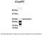 Chromatin Target Of PRMT1 antibody, ARP55300_P050, Aviva Systems Biology, Immunoprecipitation image 