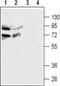 Cholinergic Receptor Nicotinic Alpha 4 Subunit antibody, PA5-77502, Invitrogen Antibodies, Western Blot image 