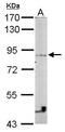 Vezatin, Adherens Junctions Transmembrane Protein antibody, GTX116241, GeneTex, Western Blot image 
