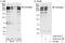 Huntingtin antibody, A302-812A, Bethyl Labs, Immunoprecipitation image 