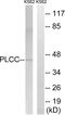 1-Acylglycerol-3-Phosphate O-Acyltransferase 3 antibody, abx014067, Abbexa, Western Blot image 