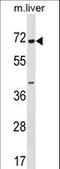 Copine 6 antibody, LS-C166997, Lifespan Biosciences, Western Blot image 