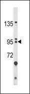 Protein bicaudal C homolog 1 antibody, 62-564, ProSci, Western Blot image 