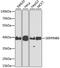 Serpin Family B Member 6 antibody, A9944, ABclonal Technology, Western Blot image 