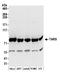 Threonyl-TRNA Synthetase antibody, A304-756A, Bethyl Labs, Western Blot image 