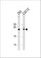 Ubiquitin Conjugating Enzyme E2 K antibody, A05895-1, Boster Biological Technology, Western Blot image 