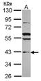 Vacuolar Protein Sorting 36 Homolog antibody, NBP2-20877, Novus Biologicals, Western Blot image 