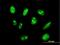 18S rRNA dimethylase antibody, H00027292-B01P, Novus Biologicals, Immunofluorescence image 