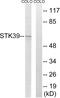 Serine/Threonine Kinase 39 antibody, GTX87705, GeneTex, Western Blot image 