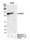 UPF1 RNA Helicase And ATPase antibody, NB100-370, Novus Biologicals, Western Blot image 