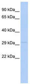 LY6/PLAUR Domain Containing 4 antibody, TA344254, Origene, Western Blot image 