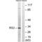 Ribosomal Protein S3 antibody, A01542, Boster Biological Technology, Western Blot image 