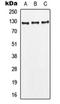 Leptin Receptor antibody, orb214184, Biorbyt, Western Blot image 