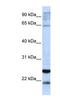 Glutathione S-Transferase Alpha 4 antibody, NBP1-54817, Novus Biologicals, Western Blot image 