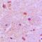 Tumor Protein P53 Inducible Nuclear Protein 1 antibody, orb215345, Biorbyt, Immunohistochemistry paraffin image 