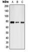 Activating Transcription Factor 6 Beta antibody, LS-C353942, Lifespan Biosciences, Western Blot image 