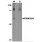 Epithelial splicing regulatory protein 1 antibody, MBS150844, MyBioSource, Western Blot image 