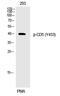 CD5 Molecule antibody, P00480, Boster Biological Technology, Western Blot image 