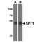 Serine palmitoyltransferase 1 antibody, TA319826, Origene, Western Blot image 