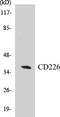 CD226 Molecule antibody, EKC1098, Boster Biological Technology, Western Blot image 