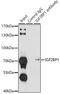 Insulin Like Growth Factor 2 MRNA Binding Protein 1 antibody, 15-085, ProSci, Immunoprecipitation image 