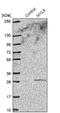 Myosin Light Chain 5 antibody, NBP1-86279, Novus Biologicals, Western Blot image 
