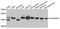 CHRNA7 (Exons 5-10) And FAM7A (Exons A-E) Fusion antibody, GTX55571, GeneTex, Western Blot image 