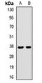 G Protein Subunit Beta 3 antibody, LS-C667826, Lifespan Biosciences, Western Blot image 