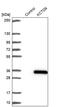 Potassium Channel Tetramerization Domain Containing 6 antibody, PA5-57519, Invitrogen Antibodies, Western Blot image 