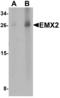 Homeobox protein EMX2 antibody, PA5-72743, Invitrogen Antibodies, Western Blot image 