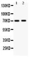 Mitogen-Activated Protein Kinase Kinase Kinase 3 antibody, PA1925, Boster Biological Technology, Western Blot image 