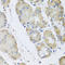 Ribosomal Protein Lateral Stalk Subunit P1 antibody, LS-C346119, Lifespan Biosciences, Immunohistochemistry frozen image 
