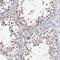 Bromodomain Containing 1 antibody, NBP1-88352, Novus Biologicals, Immunohistochemistry paraffin image 