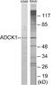 AarF Domain Containing Kinase 1 antibody, EKC1863, Boster Biological Technology, Western Blot image 