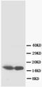 S100 Calcium Binding Protein B antibody, AM20665PU-N, Origene, Western Blot image 