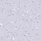 FKBP Prolyl Isomerase 11 antibody, PA5-59687, Invitrogen Antibodies, Immunohistochemistry frozen image 