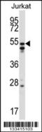 Heterogeneous Nuclear Ribonucleoprotein H2 antibody, 57-079, ProSci, Western Blot image 