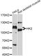 HK II antibody, MBS126518, MyBioSource, Western Blot image 