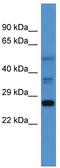 COMM Domain Containing 2 antibody, TA345067, Origene, Western Blot image 