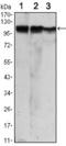 Hexokinase 2 antibody, GTX82791, GeneTex, Western Blot image 