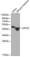 Keratin 20 antibody, GTX54340, GeneTex, Western Blot image 
