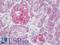 SERPINB2 antibody, LS-B10922, Lifespan Biosciences, Immunohistochemistry paraffin image 