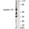 Keratin 10 antibody, A02305, Boster Biological Technology, Western Blot image 